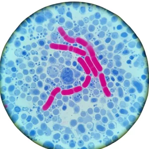 AFB Stain