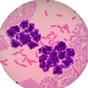 Gram Stain